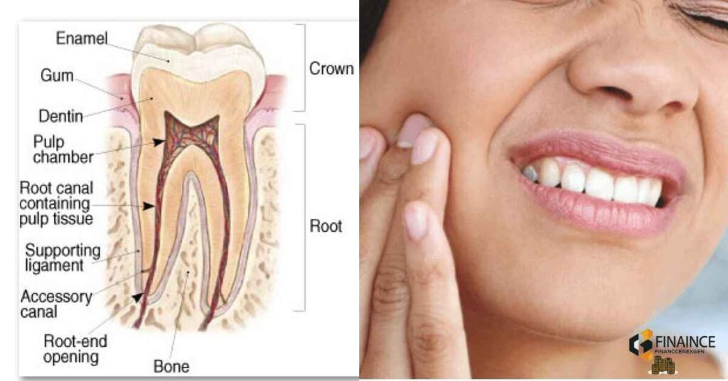 Signs You May Need a Root Canal